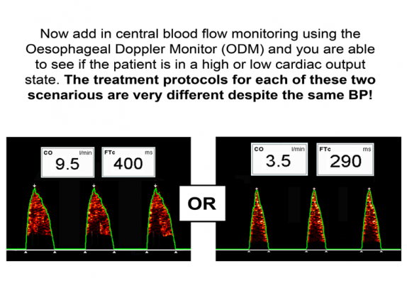 slide 3 – now add central
